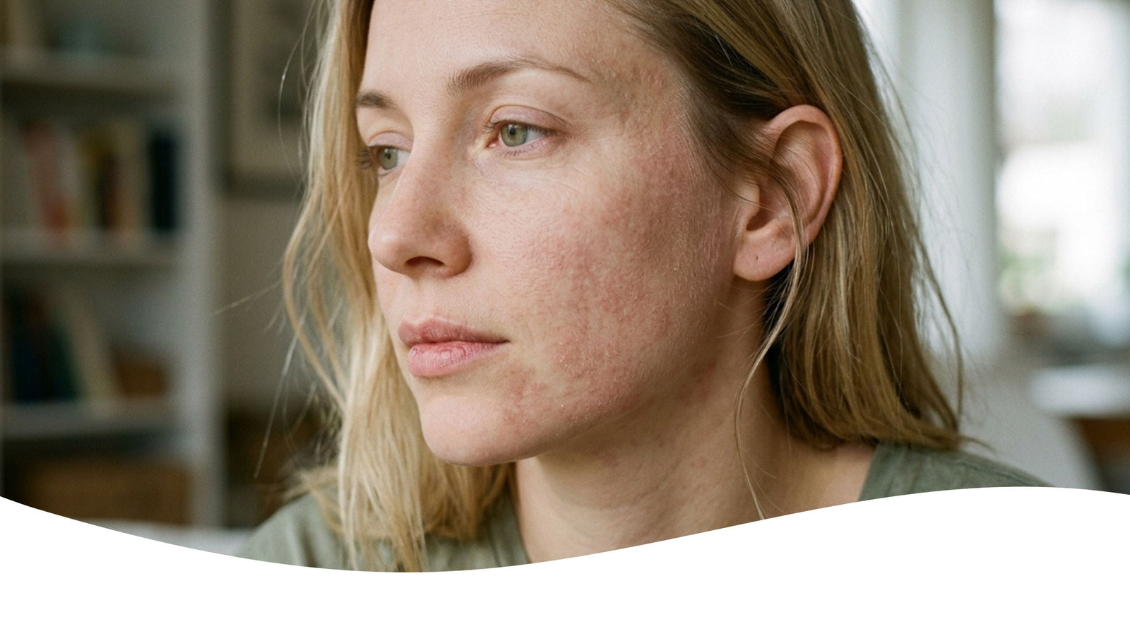 Best Sunscreen for Eczema-Prone Skin in Australia: A Dermatologist-Backed Guide