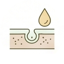 Psoriasis